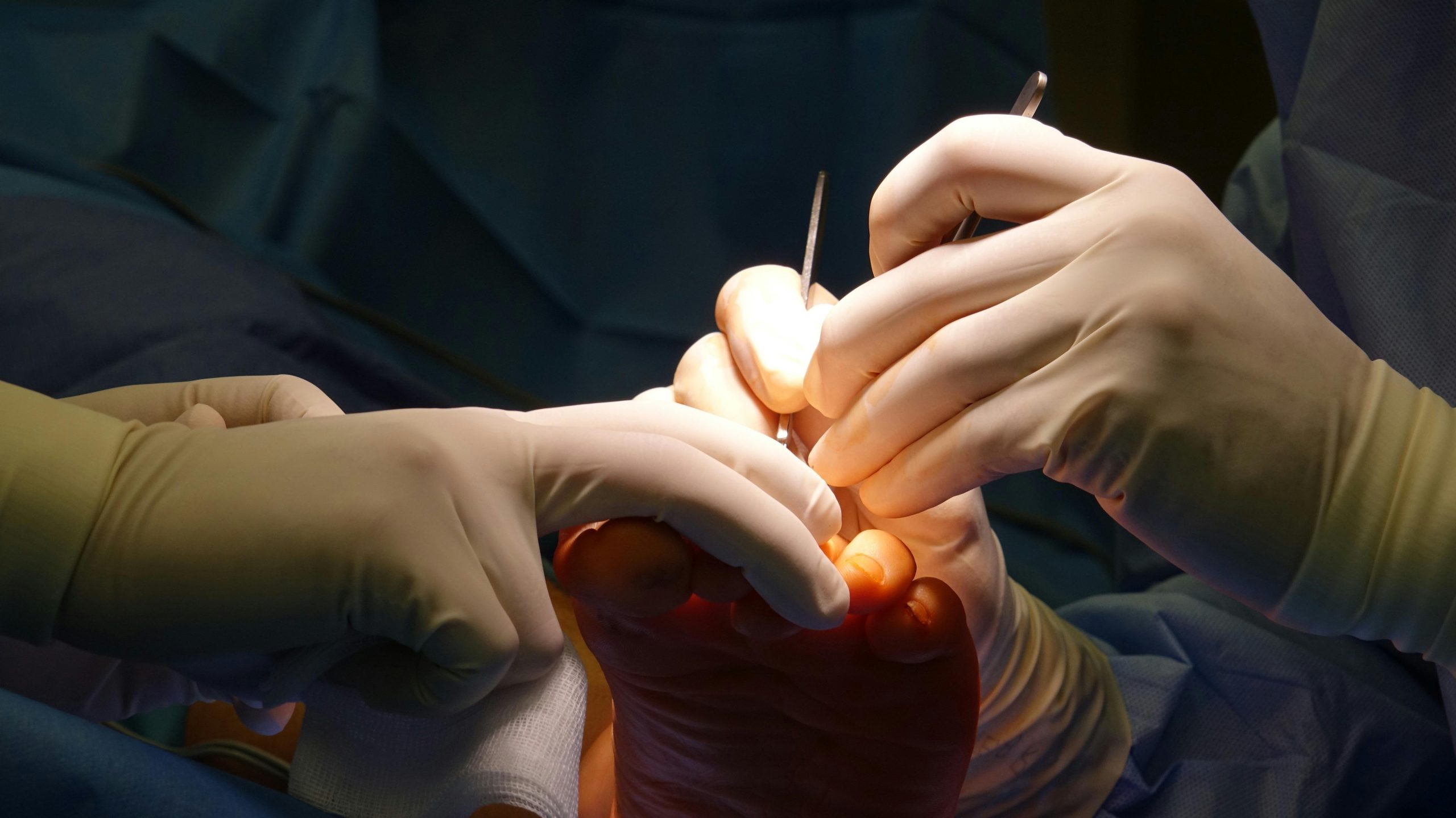 Step-by-Step Guide to LASIK Istanbul Surgery